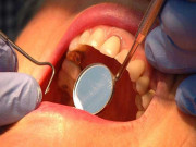 پاکستان میں منہ کے کینسر کی شرح میں ہولناک حد تک اضافہ