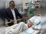 سگ گزیدگی کے شکار حسنین کے چہرے کی 3 بار سرجری