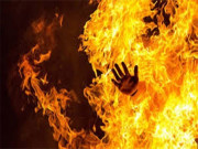 کراچی؛ گیس لیکیج سے گھر میں آگ لگنے سے میاں بیوی اور 10 سالہ بچی جھلس گئے