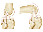 انسانی گھٹنے کے نئے حصے ’’نسیج‘‘ کی دریافت کا دعویٰ 