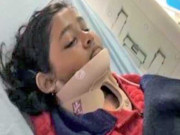 مقابلے کے دوران 12 سالہ بھارتی تیرانداز کی گردن میں تیر پیوست