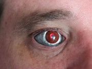 کینیڈیئن شخص آنکھ پر کیمرہ لگانے کے بعد ’آئی بورگ‘ بن گیا