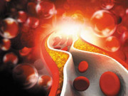 کولیسٹرول پر دھیان دینا کب شروع کریں