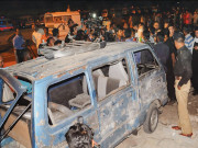 کراچی 2امام بارگاہوں کے قریب 3 دھماکے 22افراد زخمی فائرنگ سے 5 ہلاک