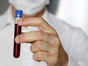 کرونا وائرس پاکستان میں داخل حکومت کا انکار