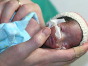 ہنگری میں دماغی طور پر فوت اور مصنوعی سانسوں پر زندہ رکھی گئی خاتون کے یہاں بچے کی پیدائش