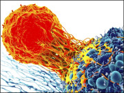 ’کرسپر‘ سے کینسر کے خلاف لڑنے والے خلیے تیار