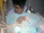 پاگل کتے کے کاٹنے سے نوجوان کی حالت غیر ہوگئی