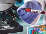 کورونا وائرس کے ٹیسٹ کیلیے نجی لیبارٹریوں میں آنے والوں کو مشکلات