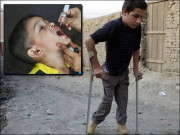 ڈھائی ماہ میں 9 مریض حکومت پولیو وائرس کیسز روکنے میں ناکام