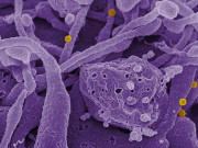 سندھ میں کورونا کے بعد کانگو وائرس سراٹھانے لگا