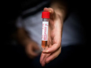 کورونا وبا علاج کیلیے پیسیو امیونائزیشن کے تحت پلازما لینے کا آغاز