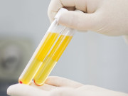 پیسوو امیونائزیشن تھراپی کے ذریعے کورونا کا پہلا مریض صحت یاب