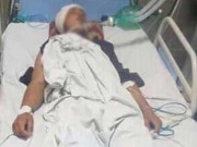 راولپنڈی بدفعلی سے انکار پر تشدد کا شکار ہونے والا 16 سالہ لڑکا دوران علاج دم توڑ گیا