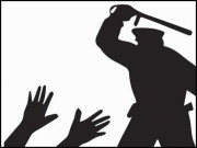 پیر آباد پولیس نے کمسن لڑکوں پر تشدد کی انتہا کر دی عدالت برہم طبی معائنے کا حکم