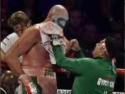 فیوری نے خون روکنے میں مدد کرنے والے کارنر مین کی مدد کردی