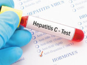 ’’ہیپا ٹائٹس فری پاکستان‘‘ کیلے تمام طبقات ملکر جدوجہد کریں ماہرین صحت