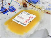 کورونا کا علاج عالمی سطح پر پلازما تھراپی کو جاری رکھنے کا فیصلہ