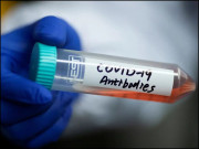 کووڈ 19 عالمی معیشت میں 3 کلیدی رجحانات کو تحریک ملی