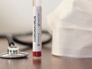 ڈومیسٹک ٹی 20 ٹورنامنٹ میں کرکٹرز کیلئے 2 کورونا ٹیسٹ منفی آنے کی شرط لازمی قرار