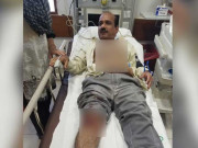 ڈکیتی واردات کے دوران مزاحمت پر فائرنگ سے ڈاکٹر زخمی