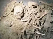 کراچی میں کچرا کنڈی سے انسانی کھوپڑیاں اور ہڈیاں برآمد