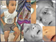 پاگل کتے نے بچوں سمیت 5 افراد کو کاٹ کر لہو لہان کردیا