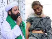 کراچی میں نمازی نے حملہ کر کے پیش امام کو زخمی کر دیا