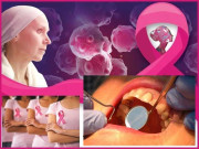 خواتین میں بریسٹ مردوں میں ہونٹوں اور منہ کا کینسر بڑھنے لگا