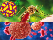 ڈینگی…کرونا کی موجودگی میں مزید خطرناک ہو سکتا ہے