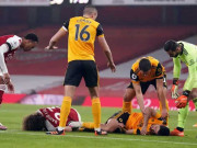 حریف سے ٹکر کی وجہ سے فٹبالر کی کھوپڑی چٹخ گئی