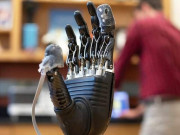 غلط انجکشن سے متاثرہ بچے کو مصنوعی بازو لگانے کا حکم