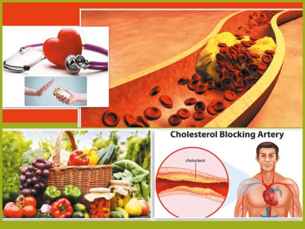 ہمارے بدن میں پیدا ہونے والی اکثر خرابیوں کی ذمے دار ہماری غذا ہی تصور کی جاتی ہے۔ فوٹو: فائل 