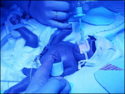 برطانیہ میں معجزاتی بچے کی پیدائش