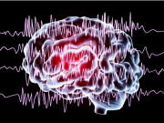 مرگی … ایک سنگین دماغی مرض