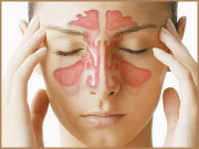 ناک بند رہنے کے اسباب علامات اور علاج