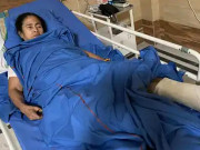 مغربی بنگال کی وزیراعلیٰ ممتا بینرجی قاتلانہ حملے میں شدید زخمی