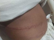 نامعلوم سفاک شخص نے ذہنی معذور نوجوان کا گردہ نکال لیا