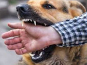 سندھ کے 11 اضلاع میں رواں سال سگ گزیدگی کے 6 ہزار واقعات