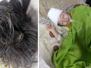 پشاور میں ہوائی فائرنگ کے دوران گولی سر میں لگنے سے بچی شدید زخمی