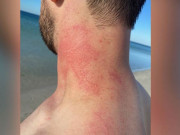 غصیلی آکٹوپس نے آسٹریلوی ماہر پر حملہ کردیا