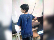 جناح اسپتال کے ڈاکٹرز کا کارنامہ 14 سالہ بچے کا انتہائی پیچیدہ آپریشن کامیاب