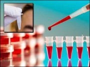 ڈپریشن کا پتا چلانے والا بلڈ ٹیسٹ ایجاد کرلیا گیا