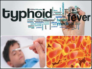 ٹائیفائیڈ بخار سے کیسے چھٹکارا پائیں
