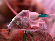 پشاور میں غیر معیاری آکسیجن سلنڈرز سے بلیک فنگس پھیلنے کا خدشہ