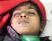 ڈاکٹر نے نہیں گرایا خوف کی وجہ سے نیچے گرا ہریش کمار
