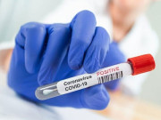 بیجنگ کورونا کے دوران خدمات کے اعتراف میں 2 پاکستانی سفارت کاروں کو تمغہ امتیاز سے نوازا گیا