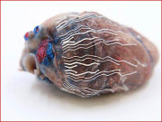 سرجری کے دوران ازخود تصاویر کھینچنے اور محفوظ کرنے والا بایوسینسر