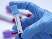 کورونا وبا مزید 39 افراد جاں بحق 930 نئے کیسز رپورٹ