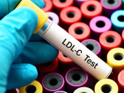 کولیسٹرول گھٹانے والی غالباً سب سے مؤثر اور مہنگی دوا کی منظوری